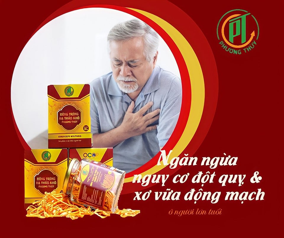 Ngăn ngừa nguy cơ đột quỹ và xơ  vữa động mạch